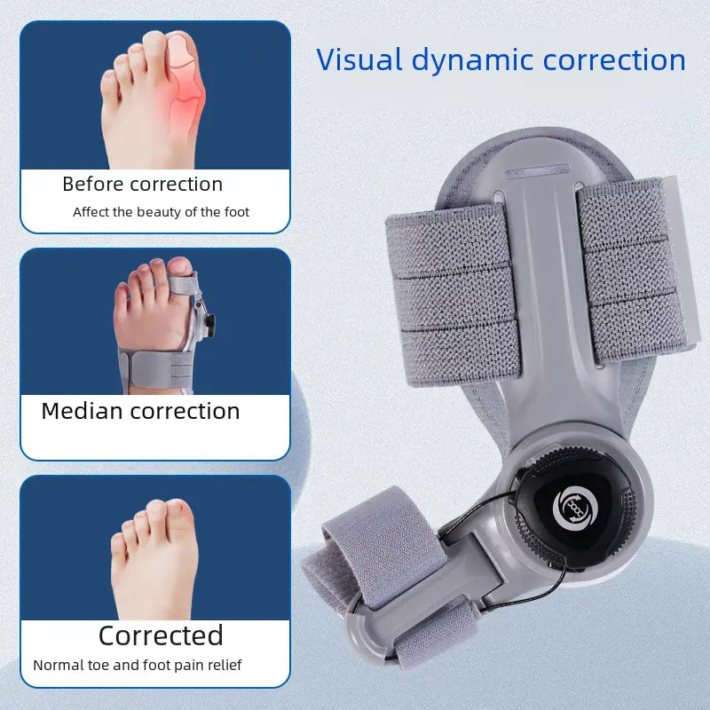 Upgraded Adjustable Bunion Corrector My Store